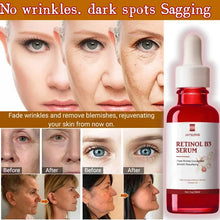 Load image into Gallery viewer, Anti-Aging Face Serum for Lines Wrinkles &amp; Premature Sun Damage Remove Face Dark Spot with Vitamin B3
