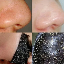 Load image into Gallery viewer, Black Facial Mask Remove Blackheads Absorb Acne Men And Women
