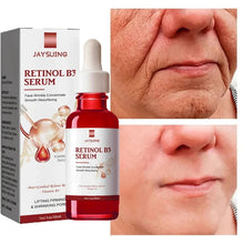 Load image into Gallery viewer, Anti-Aging Face Serum for Lines Wrinkles &amp; Premature Sun Damage Remove Face Dark Spot with Vitamin B3
