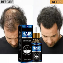 Load image into Gallery viewer, Hair Growth Oil Effective Rapid Repair
