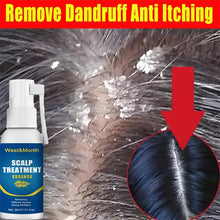 Load image into Gallery viewer, Hair Care Spray Fast Anti Exfoliating Remove Dandruff Anti Itching Treatment
