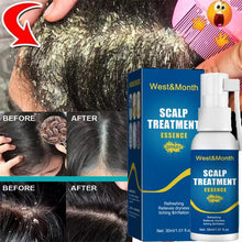 Load image into Gallery viewer, Hair Care Spray Fast Anti Exfoliating Remove Dandruff Anti Itching Treatment
